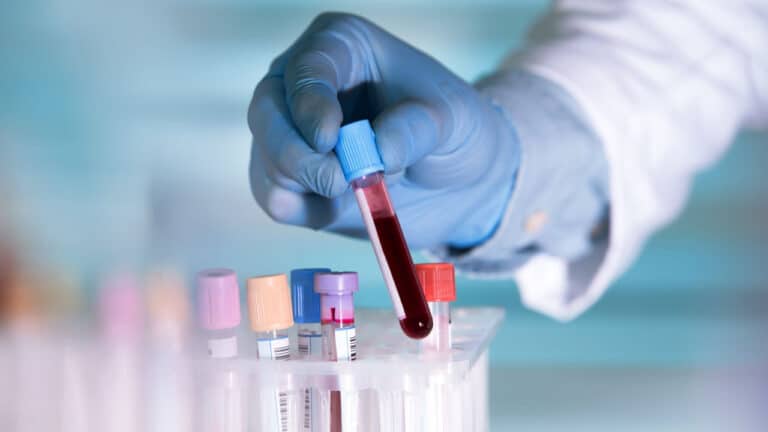 blood-test_shutterstock.jpg