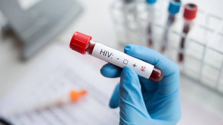hiv_aids_shutterstock_1224734254.jpg